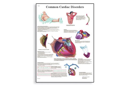 Common Cardiac Disorders Chart.jpg