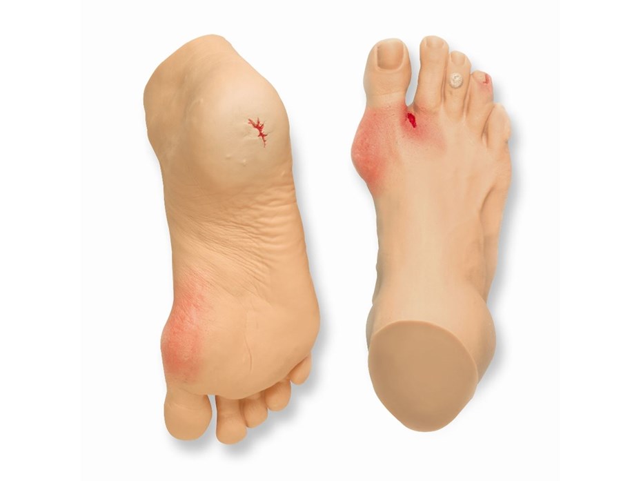 Common Foot Problems Display.jpg