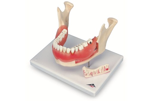 Dental Disease Model.jpg