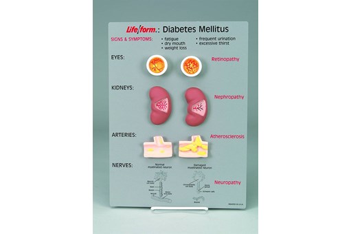 Diabetes Mellitus Teaching Kit.jpg