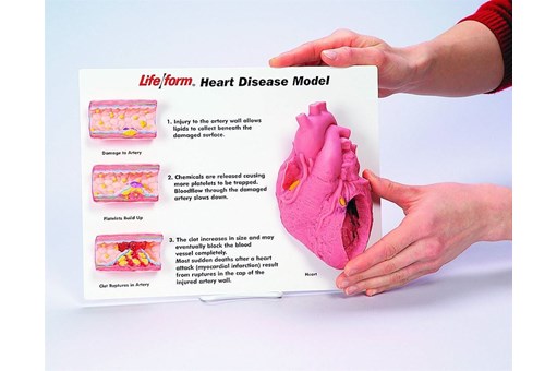 Heart Disease 3D Display Kit.jpg