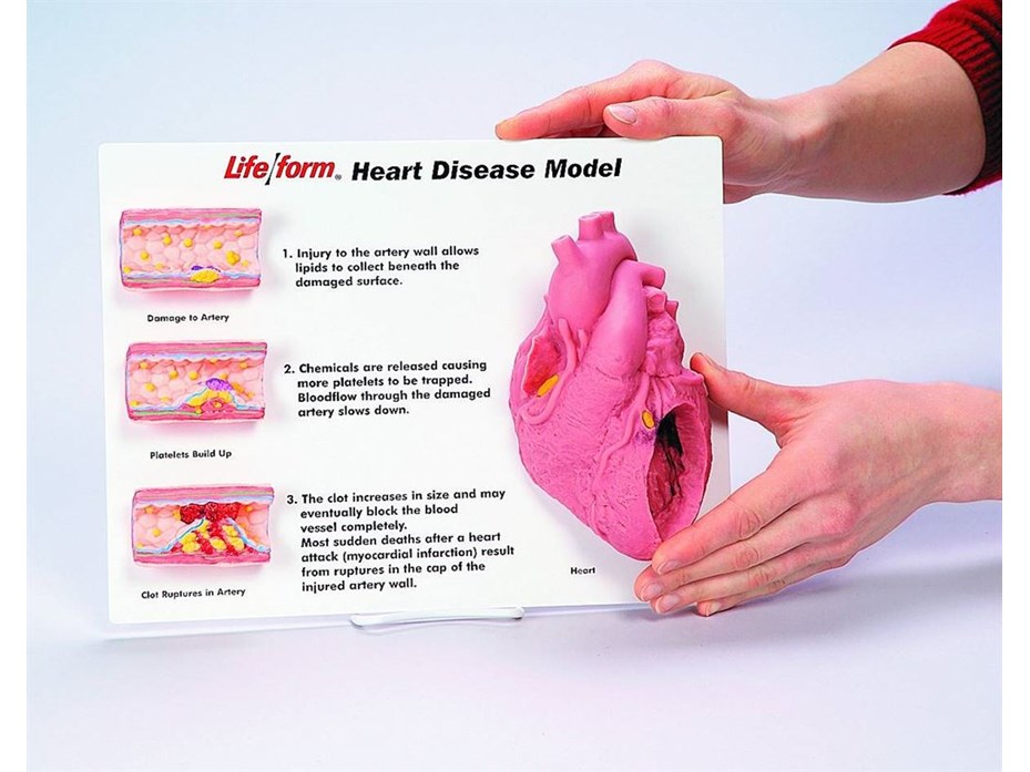 Heart Disease 3D Display Kit.jpg