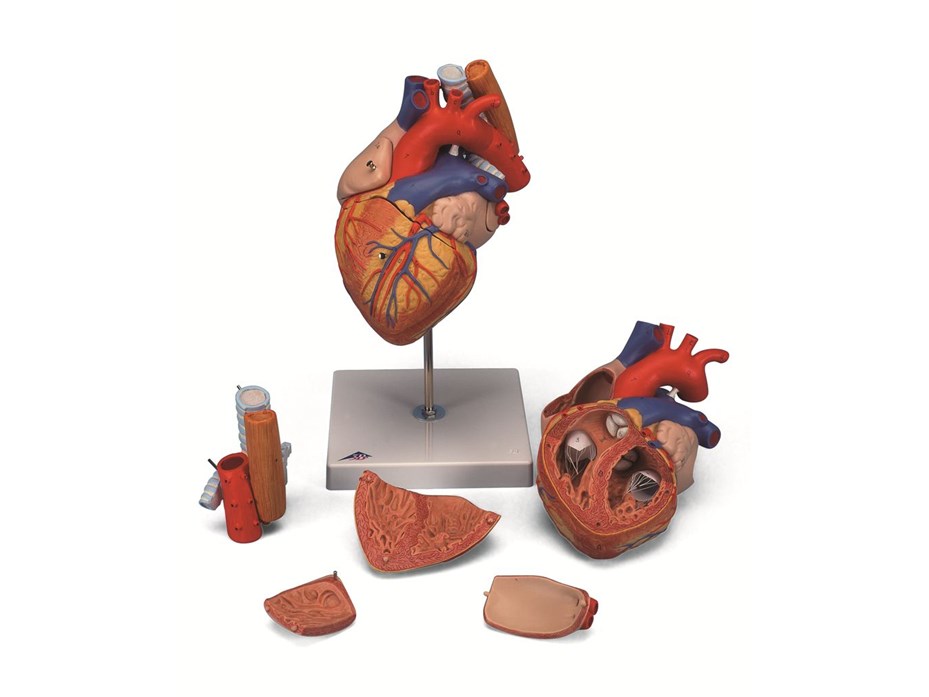 Heart with Oesophagus and Trachea.jpg