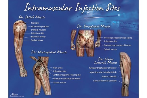 Intramuscular Injection Sites Poster.JPG