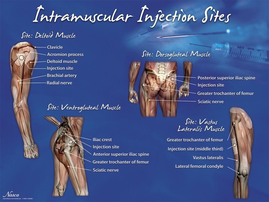 Intramuscular Injection Sites Poster.JPG